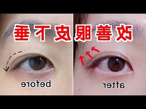 眼尾 面相